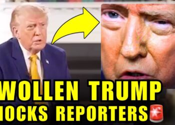 🚨Trump STUNS The Media With SWOLLEN EYE And CRAZY INTERVIEW
