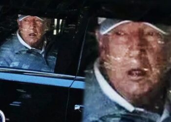 Trump photographed with “dementia face”